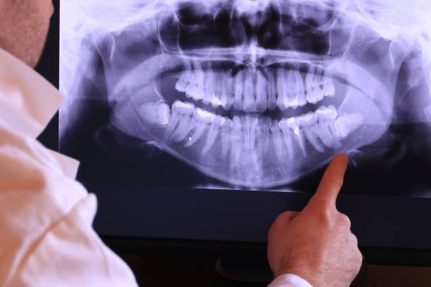 Best Emergency Wisdom Teeth Removal in Fritz Creek, AK